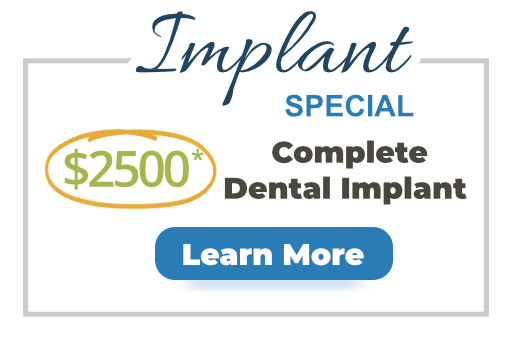 $2500 Complete dental implant
